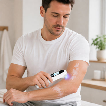 Portable 308nm UVB Phototherapy Wand for Vitiligo