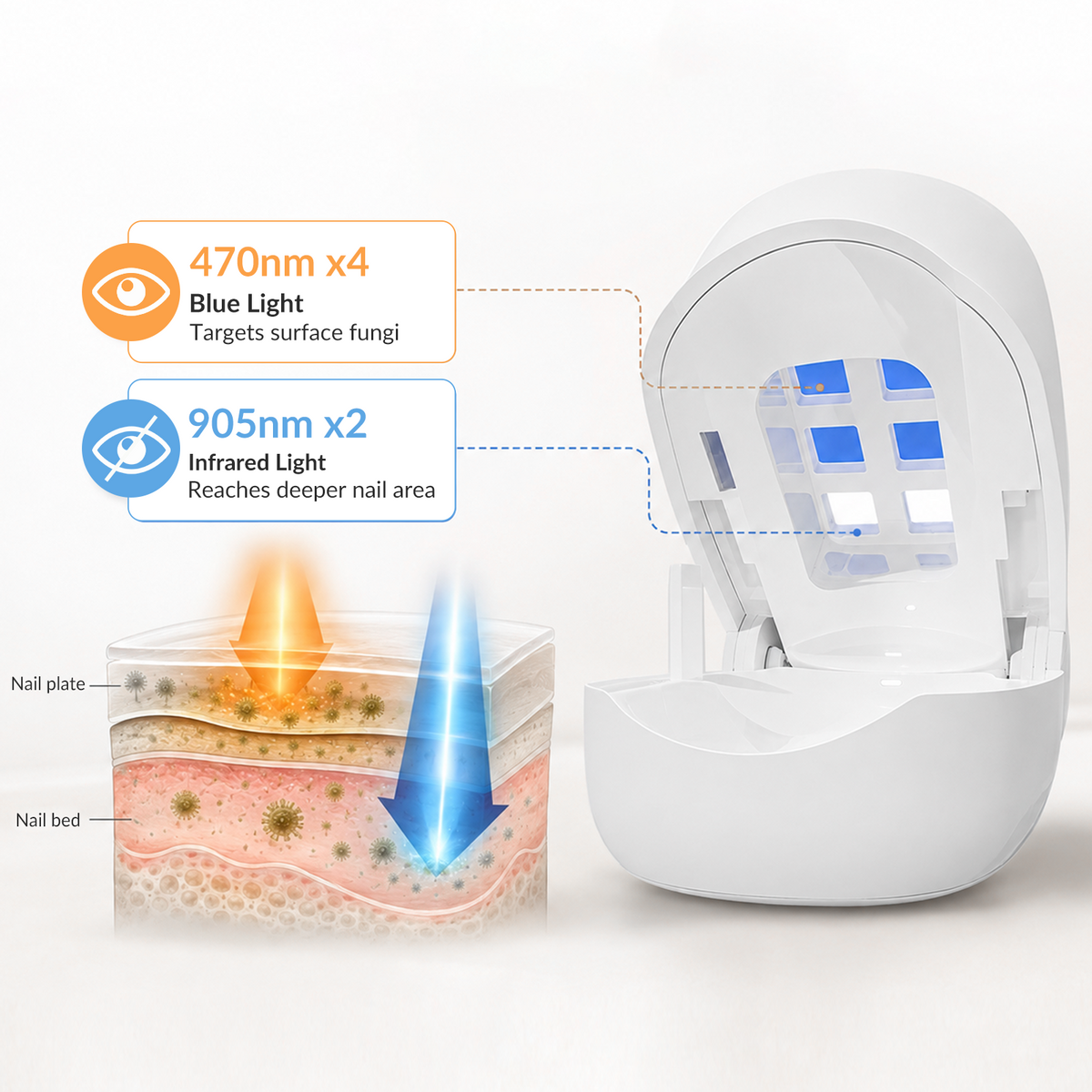 470nm Blue & 905nm Infrared Light Nail Fungus Treatment Laser Device