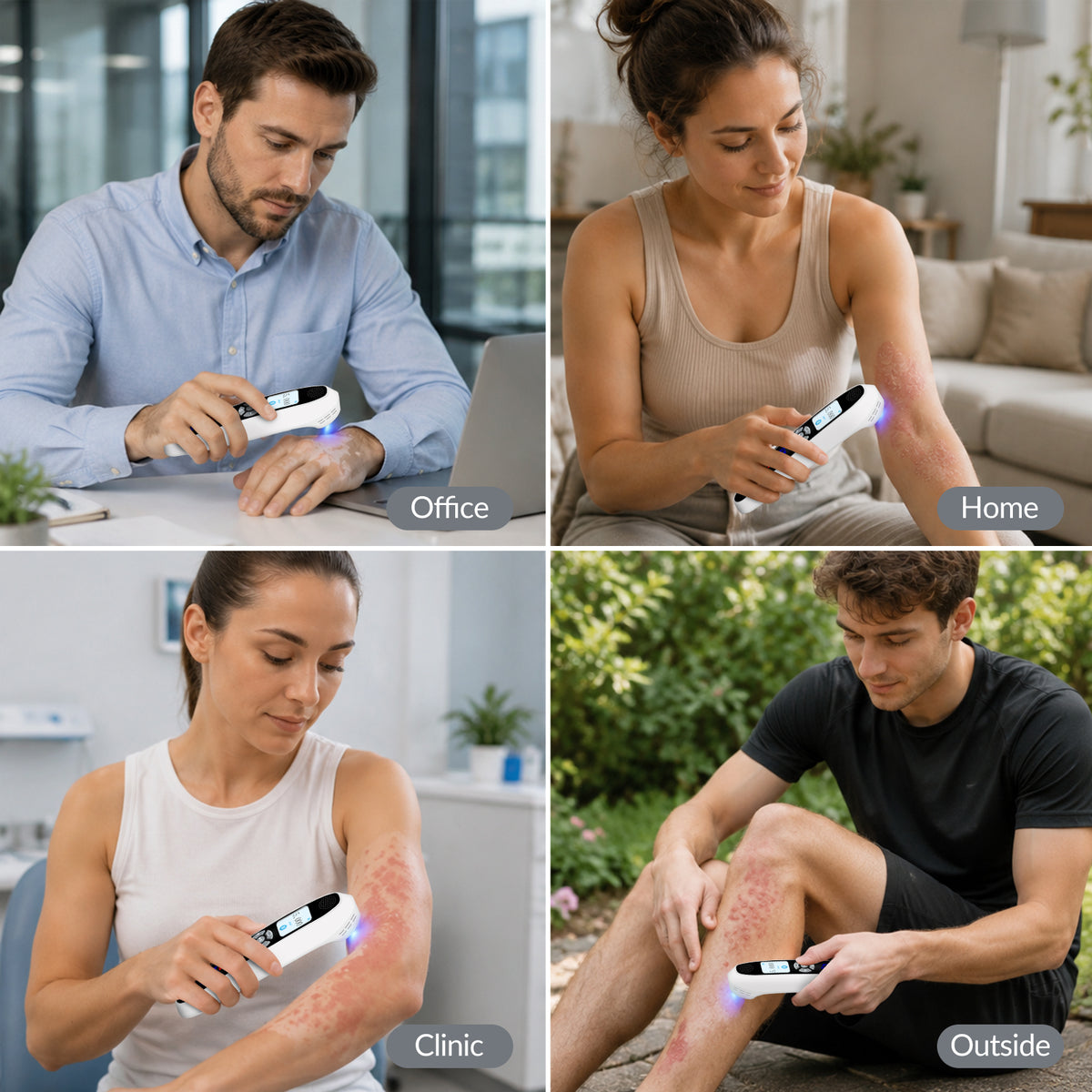 ZJZKTOP 308nm Excimer UVB Light Therapy Device, Handheld Targeted Phototherapy Lamp for Vitiligo, Psoriasis & Eczema, Rechargeable Portable Home Skin Treatment