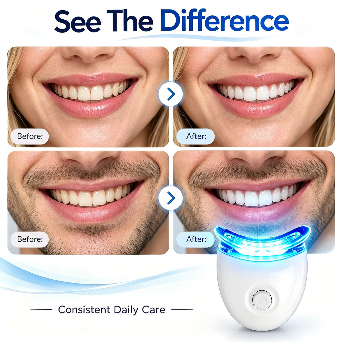 LED Teeth Whitening Home Kit with Gel & Mouth Trays