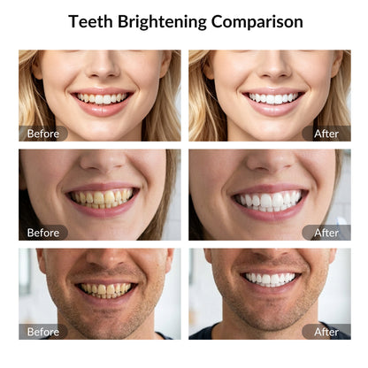 32 LEDs Rechargeable Wireless Teeth Whitening Light